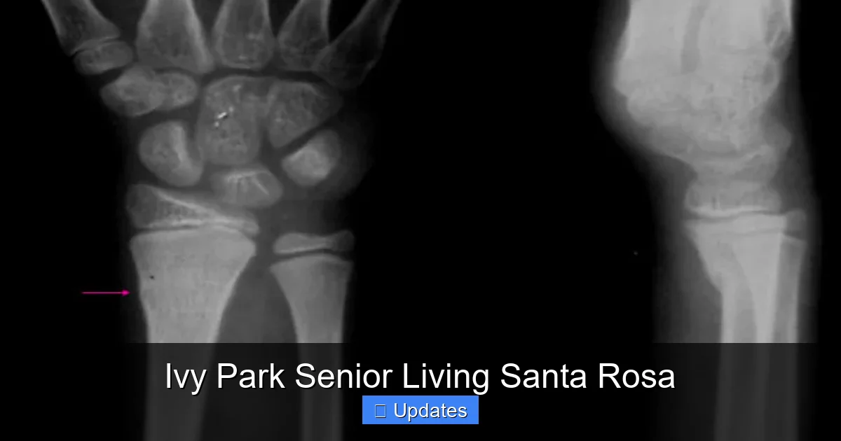Ivy Park Senior Living Santa Rosa