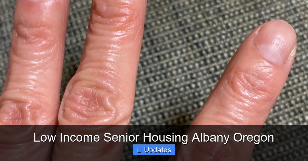 Low Income Senior Housing Albany Oregon